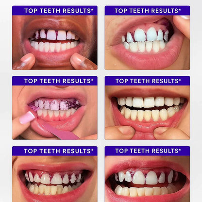 MINTI - SMILE Whitening strips