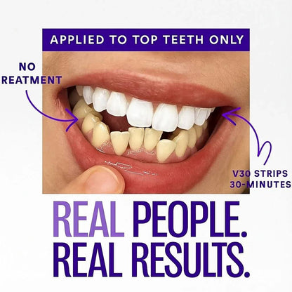 MINTI - SMILE Whitening strips